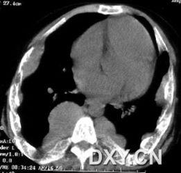 贫血症图片,揭秘血液健康危机